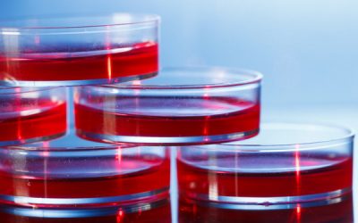 Las células de corazón derivadas de células madre son necesarias para avanzar en la comprensión de la dolencia cardiaca en la Ataxia de Friedreich