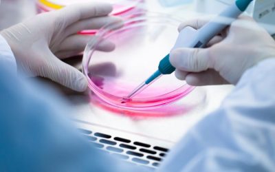 La restauración de la expresión de frataxina podría detener la progresión de la FA