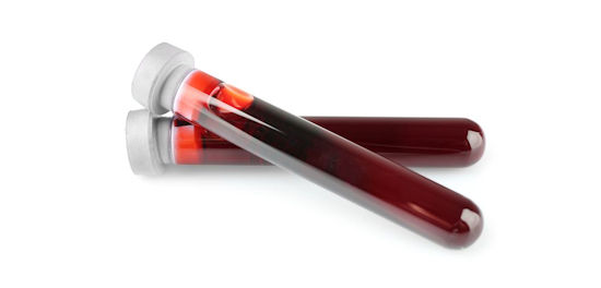 biomarcadores sanguíneos
